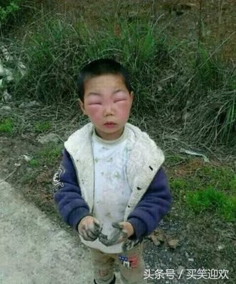 主要中医治疗:腰椎间盘突出，颈椎病，关节炎，肩周炎，滑膜炎等！！！V:13356658857