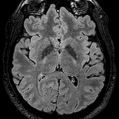 Geek et neuroradiologue. #médecine #neurosciences #informatique ... et un peu #droit aussi