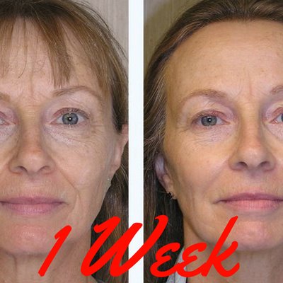 If you would love to have younger looking skin vanishing those wrinkles instantly Click Here https://t.co/udeiJrYlLR