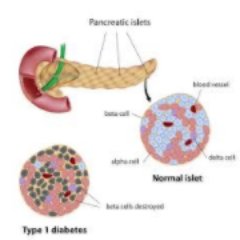 I only use Bound-Oxygen to controls my #Diabetes, this is my experimentation of doing it #naturally, share your #advice, if you have advice?