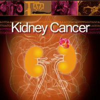 Kidney Cancer(@KCA_Journal) 's Twitter Profileg