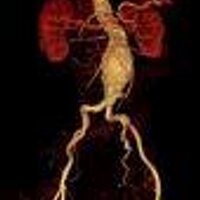 Vascular Surgery (@vascularsurgery) 's Twitter Profile
