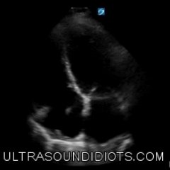 Ultrasoundidiots