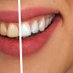 Dazzling White Teeth HQ (@dazzlingwhitehq) Twitter profile photo Dazzling White Teeth HQ (@dazzlingwhitehq) Twitter profile photo