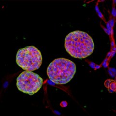 Prostate & Pancreatic cancers, 3D organoids, organoids-on-chip, RNAi screen, 3D Bioprinting