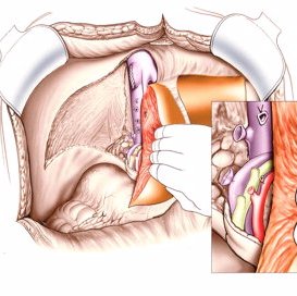 The most cited Journal: Journal of Transplantation Technologies & Research

We publish all types of Articles 
please visit our website for more information