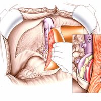 Journal of Transplantation Technologies & Research (@jottrsci) 's Twitter Profile