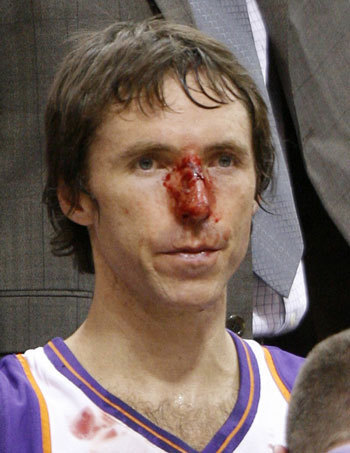 SMASH THE NASH. Lets go LAKESHOW