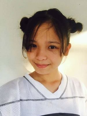 Imperfections😖
IG:ella_pangit
