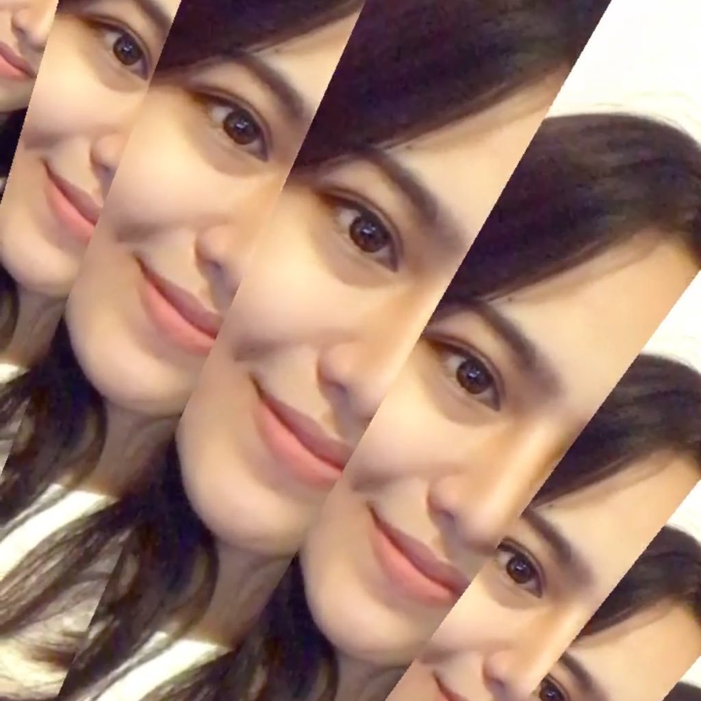 อุปส์