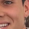 Just a dimple ⚡️main- @scapedolan follow me ❤️