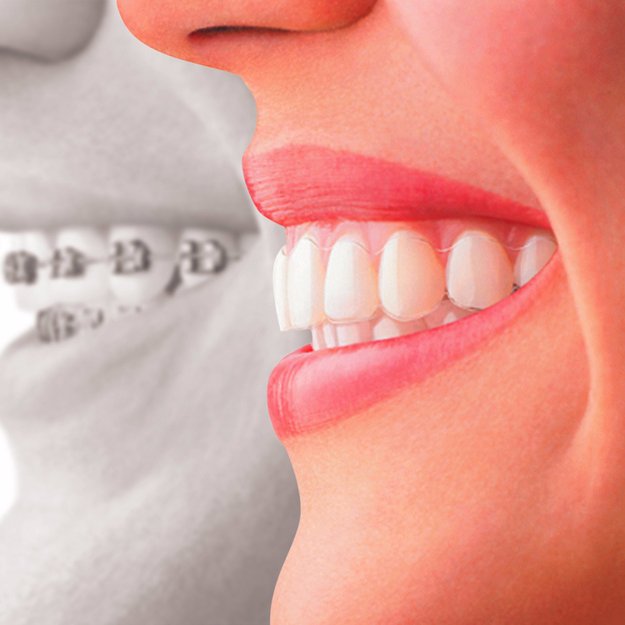 Maple Dental Clinic
102a Cleveland Street
London W1T 6NT UK
Tel. 02036092548
Email. mapledentalclinic@live.co.uk
Dr. Leo Ghabai (DDS) Sweden
