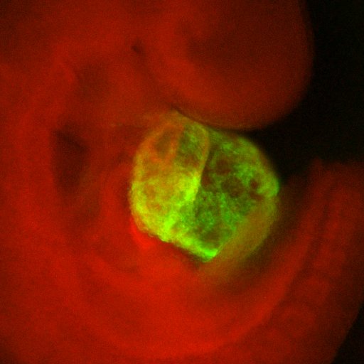 The research goal of the Trivedi lab is to identify cellular processes and regulatory mechanisms involved in human cardiac and vascular diseases.