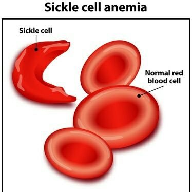 Championing for the rights and freedoms of poor people overcome the pangs of Sickle Cell Disease thus living a fulfilling and worthwhile lives.