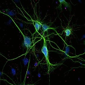 We study cell signaling in the heart and brain and are always looking for new team members!