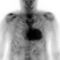 Amyloidosis_papers (@amyloid_papers) 's Twitter Profile Photo Amyloidosis_papers (@amyloid_papers) 's Twitter Profile Photo