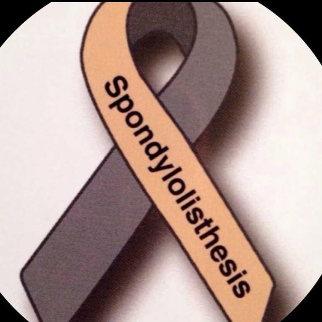 The #Spondylolisthesis (Anterolisthesis & Retrolisthesis) Support, Information and Awareness Project. Join our community! You are NOT alone! #TheSSIAProject