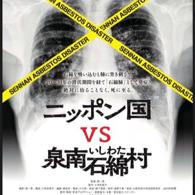 世界が震撼した『ゆきゆきて、神軍』から31年ーー 原一男監督最新作 映画『ニッポン国VS泉南石綿村』 2018年3月10日より東京・ユーロスペース、横浜・ジャック＆ベティにて公開！！2月3日よりイオンシネマりんくう泉南にて一週間限定先行上映！！