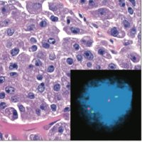 WCM Prostate SPORE (@wcm_pca_spore) 's Twitter Profile