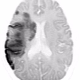 North of England Acute Neurology Update  

BACK IN 2025