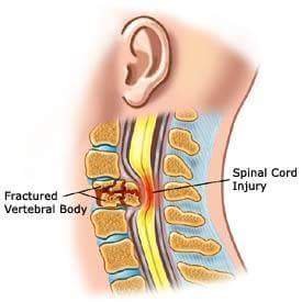 We individuals suffering from spinal cord injury love writing and sharing articles about post spinal cord injury life based on research and personal experiences