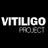 VitiligoProject