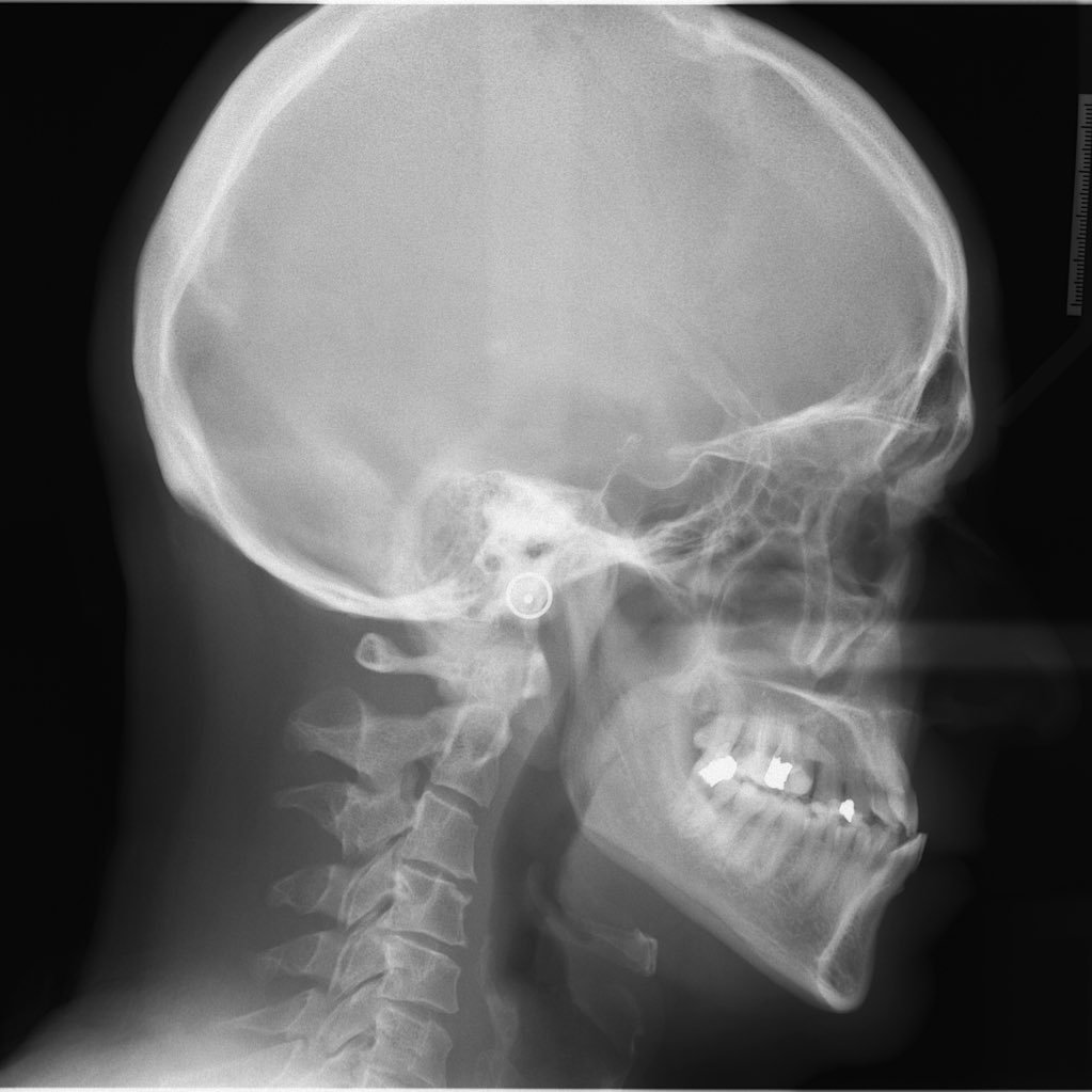 ManX_Abdelaziz's profile picture. Work in medical imaging