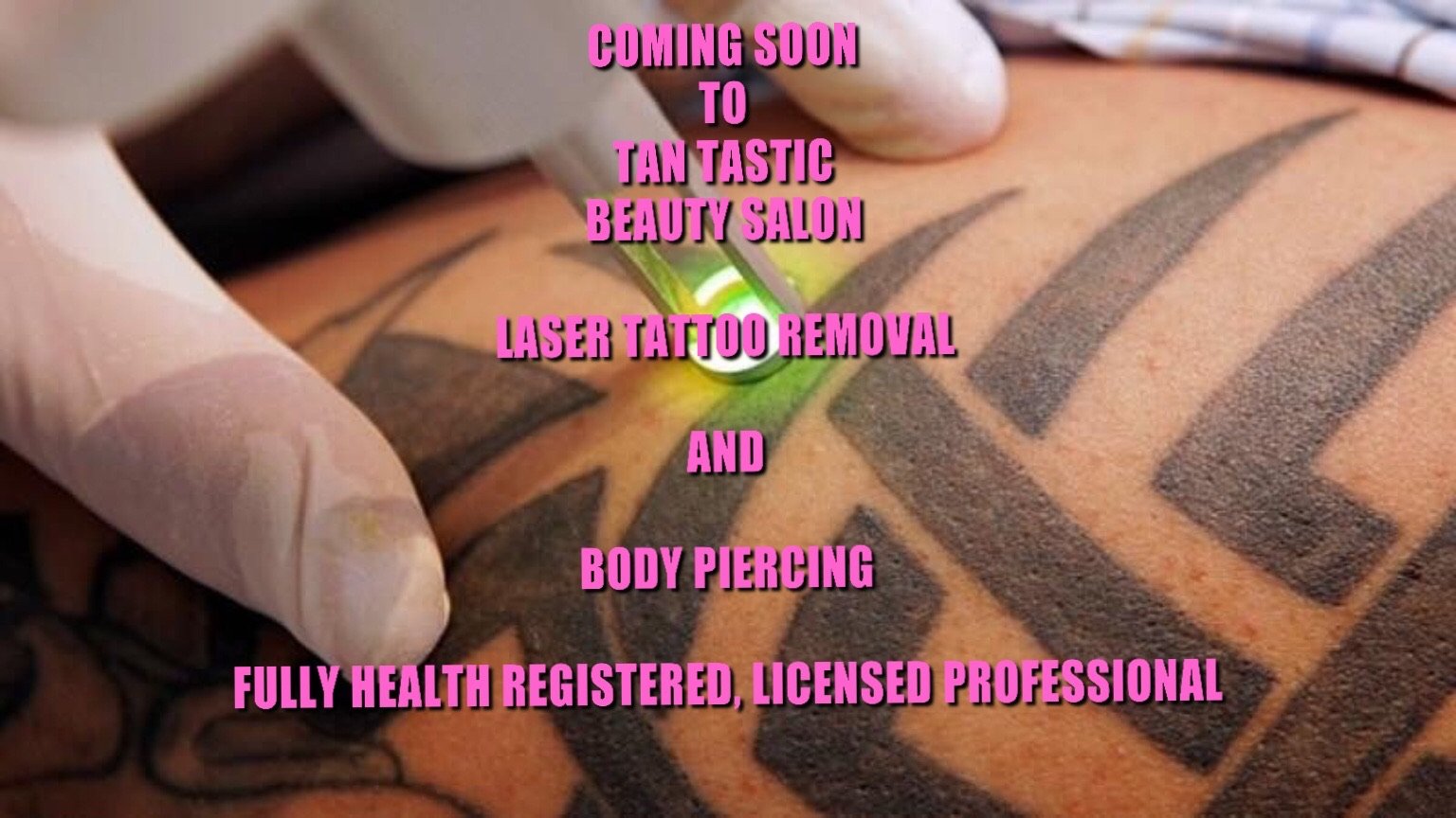 LaserTattooIPL's profile picture. BOOK NOW 07506429010