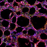 Translational Tissue Engineering Center (@ttecjhu) 's Twitter Profile