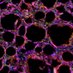 Translational Tissue Engineering Center (@ttecjhu) Twitter profile photo Translational Tissue Engineering Center (@ttecjhu) Twitter profile photo