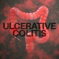 Ulcerative Colitis (@ulcerativecol) 's Twitter Profile