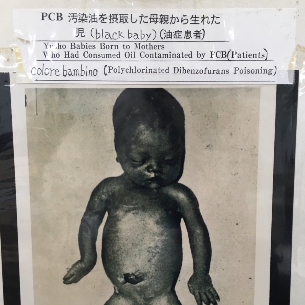 黒い赤ちゃんが生まれたカネミ油症と環境汚染を考えます。 カネカの兵庫県高砂事業所のPCBダイオキシンを含む底泥を処分をする際に、得られる知見が、カネミ油被害者を救済できると思います。 歴史から学ぶことが大切です。