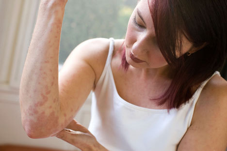 All the latest news for you on Eczema and Rash creams, treatments, and symptoms. Keep up-to-date on everything you need to know!