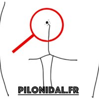 Kyste Pilonidal (@kyste_pilonidal) 's Twitter Profile