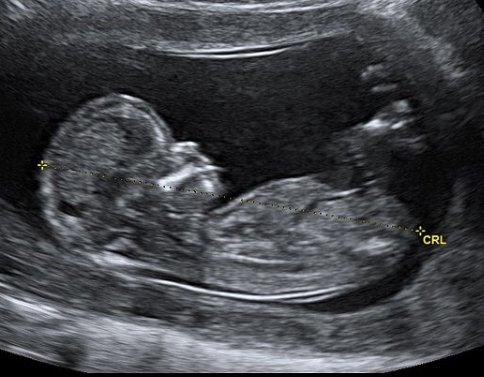 rcmoyer's profile picture. 