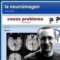 miguel blanco (@neuroimagen) 's Twitter Profile