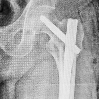 smart7406's profile picture. Médico cirujano de cadera