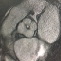 SECardiología: CRM Y TC(@RMTC_secardio) 's Twitter Profile Photo