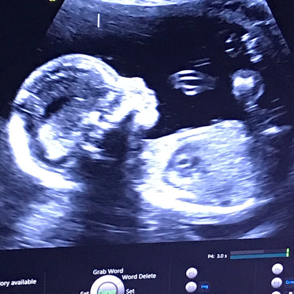 Woodring06's profile picture. Husband and Father of 2. Math Teacher @ Davie High School Isaiah 40:31 App State University Grad