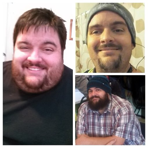 LifeAfterBurger's profile picture. My journey through Weight Loss surgery and how I am changing my life around!