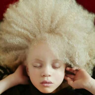 ResearchProje10's profile picture. contents relating to albinism