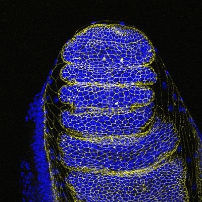 #morphogenesis #biomechanics #apoptosis #EMT #biophysical #modelling