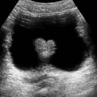 Artur Roman (@radiologiaartur) 's Twitter Profile Photo Artur Roman (@radiologiaartur) 's Twitter Profile Photo