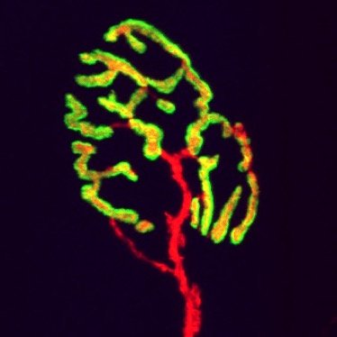 Integrating biology and stem cell engineering for skeletal muscle aging and pathophysiologies.