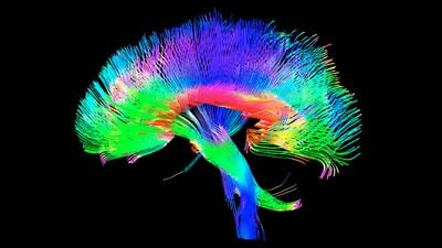 🔸Cada cerebro es único, ¿por qué la educación es igual para todos?🔸 Acercando la Neuropsicología y la Educación 🔸