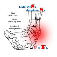 L'ENTORSE DAUPHINOISE🐪🐉#TTFL (@lentorse) 's Twitter Profile