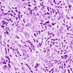 My Neuropath News (@neuropathclinic) Twitter profile photo My Neuropath News (@neuropathclinic) Twitter profile photo