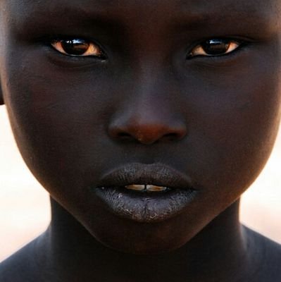 We are a small international organisation working to fight poverty and disease in the poorest parts of the world.