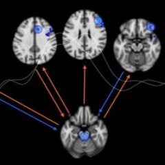 LIINClab's profile picture. We study rapid decision making in the human brain using multimodal non-invasive measures of neural, physiological and behavioral activity. PI: Paul Sajda