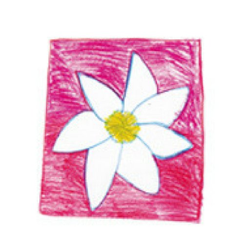 Neuroblastoma Au Profile